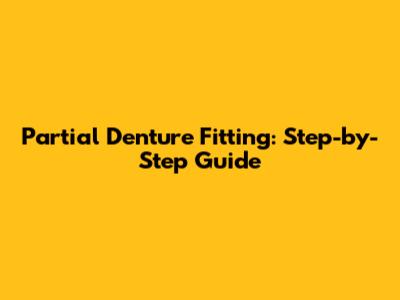 Partial Denture Fitting: Step-by-Step Guide